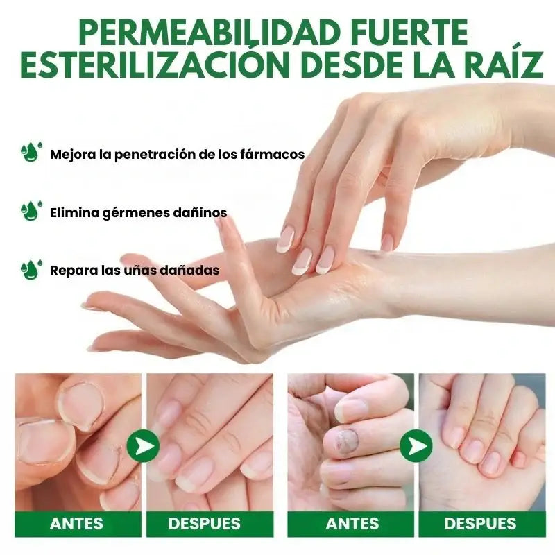 7 Days Fungus Free Nails® - Elimina El Hongo de Tus Uñas ➕ Envió Gratis