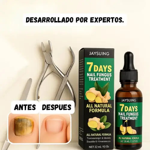 7 Days Fungus Free Nails® - Elimina El Hongo de Tus Uñas ➕ Envió Gratis