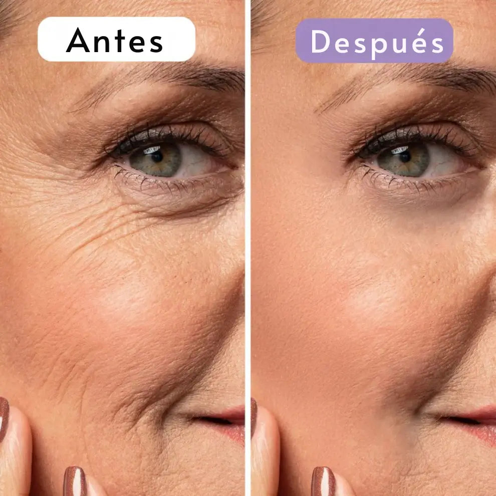 Cinta Cicatrizante de Silicona Contra Cicatrices y Arrugas ➕ Envío Gratis