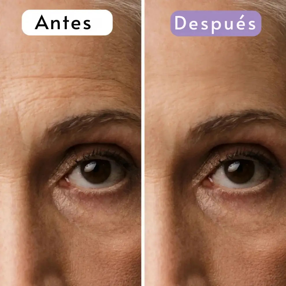 Cinta Cicatrizante de Silicona Contra Cicatrices y Arrugas ➕ Envío Gratis