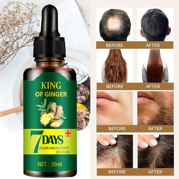7DAYS ™ ACEITE ESENCIAL DE JENGIBRE REVITALIZANTE ANTI CAIDA Y CRECIMIENTO ACELERADO PARA EL CABELLO