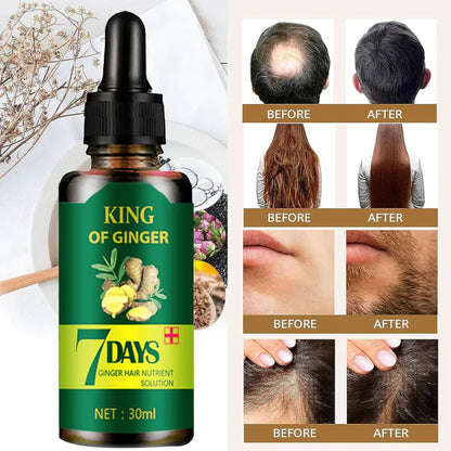 7DAYS ™ ACEITE ESENCIAL DE JENGIBRE REVITALIZANTE ANTI CAIDA Y CRECIMIENTO ACELERADO PARA EL CABELLO