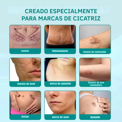 Spray Eliminación Cicatrices ➕ Envío Gratis