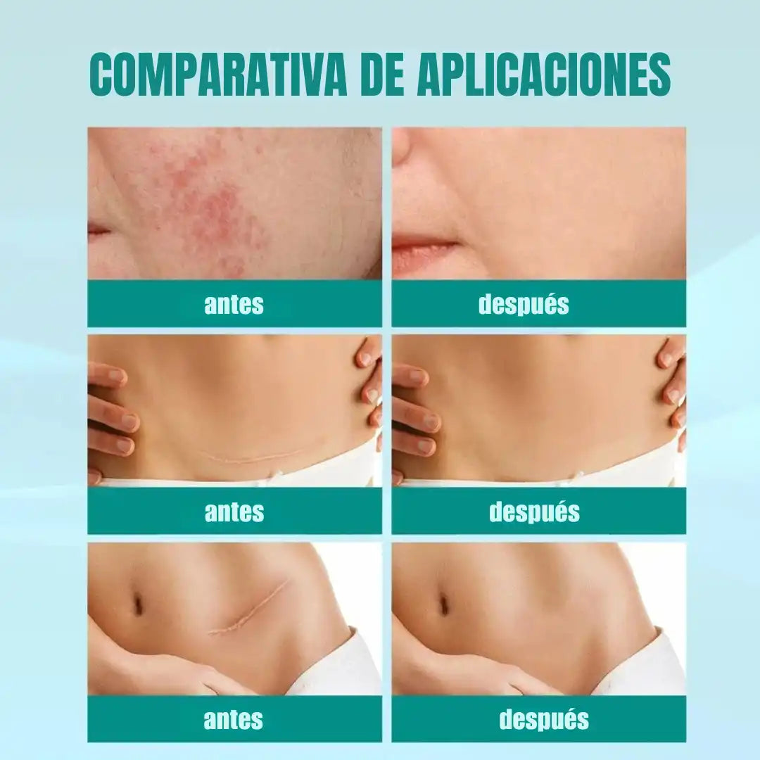 Spray Eliminación Cicatrices ➕ Envío Gratis