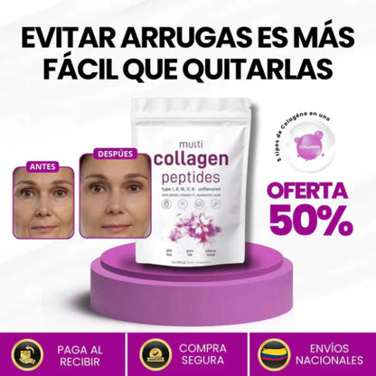 COLAGENO PURO MULTIPLES VITAMINAS 5 EN 1 – FORTALECE ARTICULACIONES, PIEL Y CABELLO