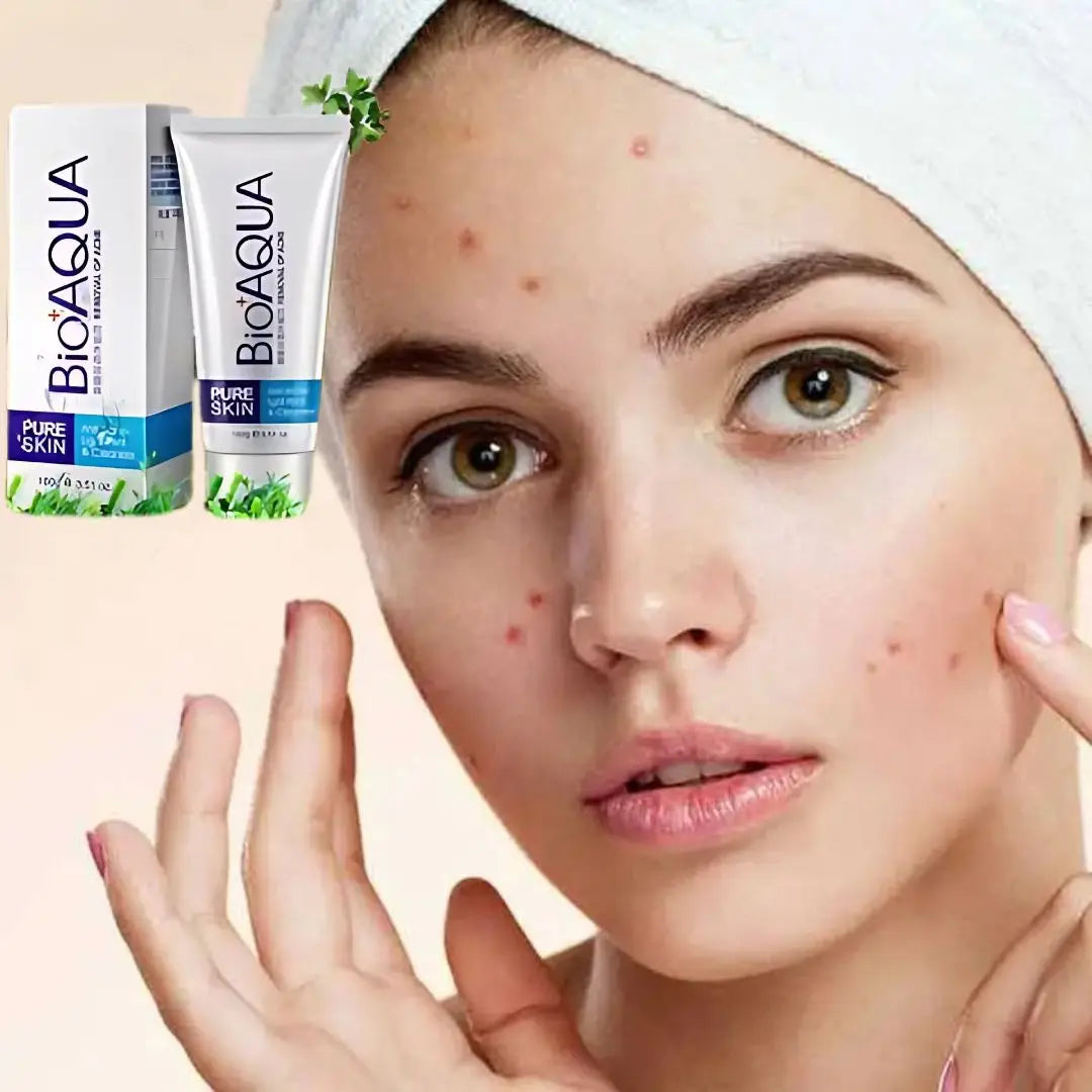 Combo Anti Acné 🎁 Por Tu Compra Recibe un Regalo ➕ Envío Gratis