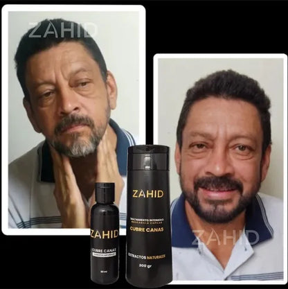 Shampoo Cubre Canas Instantáneo 🎁 Regalos por tu Compra ➕ Envío Gratis