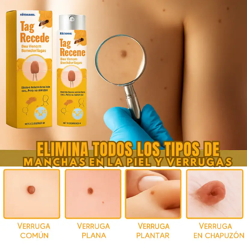 Spray "Tag Recede" con la nueva tecnología "Nano Fit Spot™ ➕ Envío Gratis