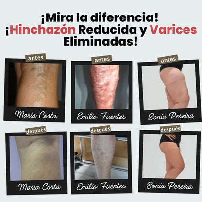 Calcetines de Acupresión Anti-Varices 🔥 Alivio, Comodidad y Bienestar ➕ Envío Gratis