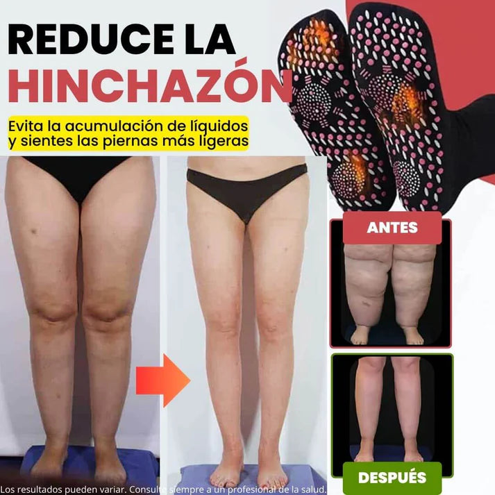 Calcetines de Acupresión Anti-Varices 🔥 Alivio, Comodidad y Bienestar ➕ Envío Gratis