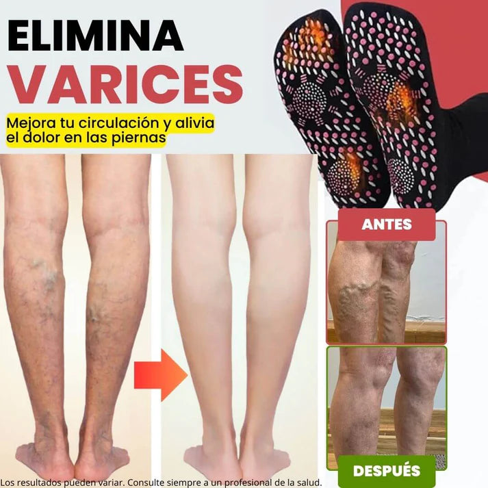 Calcetines de Acupresión Anti-Varices 🔥 Alivio, Comodidad y Bienestar ➕ Envío Gratis