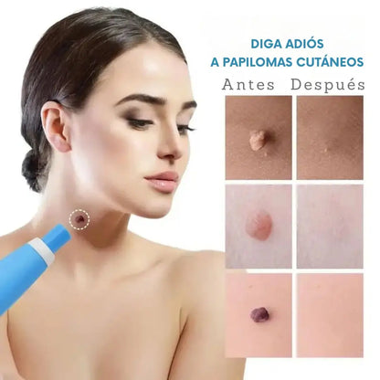 Removedor de Verrugas 🎁 Crema Reparadora Veneno de Abeja ➕ Envió Gratis