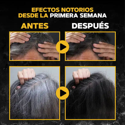 BlackSoap Jabón Anti Canas ➕ PROMO 2x1! COMPRA 1 Y LLEVA 2 ➕ ENVÍO GRATIS