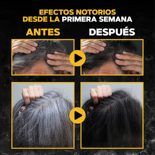Efectivo Jabón Anti Canas ➕ Envió Gratis
