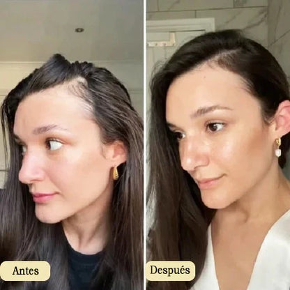 Aceite Natural Veganic 🎁 Compra 1 Lleva 2 - Para Doble Crecimiento del Cabello ➕ Envío Gratis