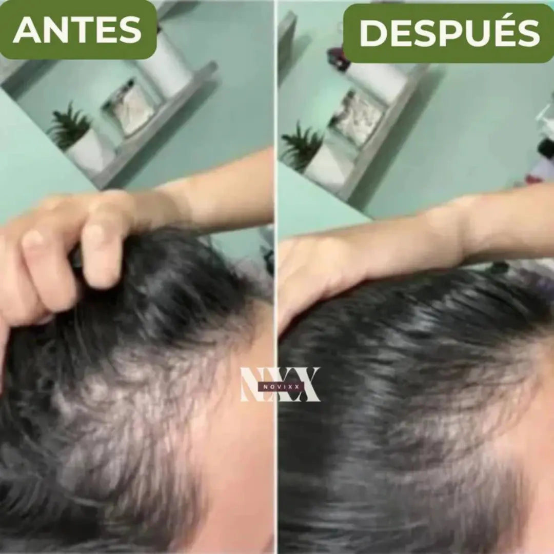 Shampoo Natural de Batana y Extracto de Romero ➕ Envío Gratis
