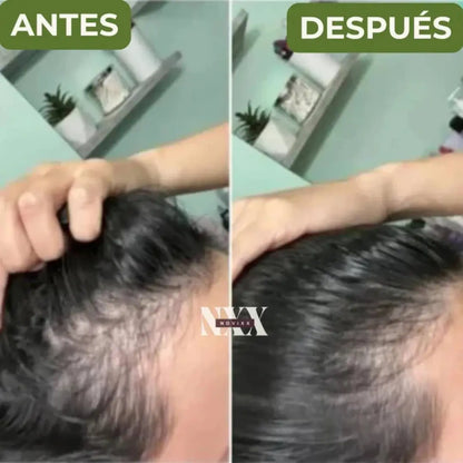 Shampoo Natural de Batana y Extracto de Romero ➕ Envío Gratis