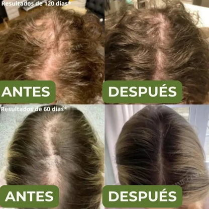 Shampoo Natural de Batana y Extracto de Romero ➕ Envío Gratis