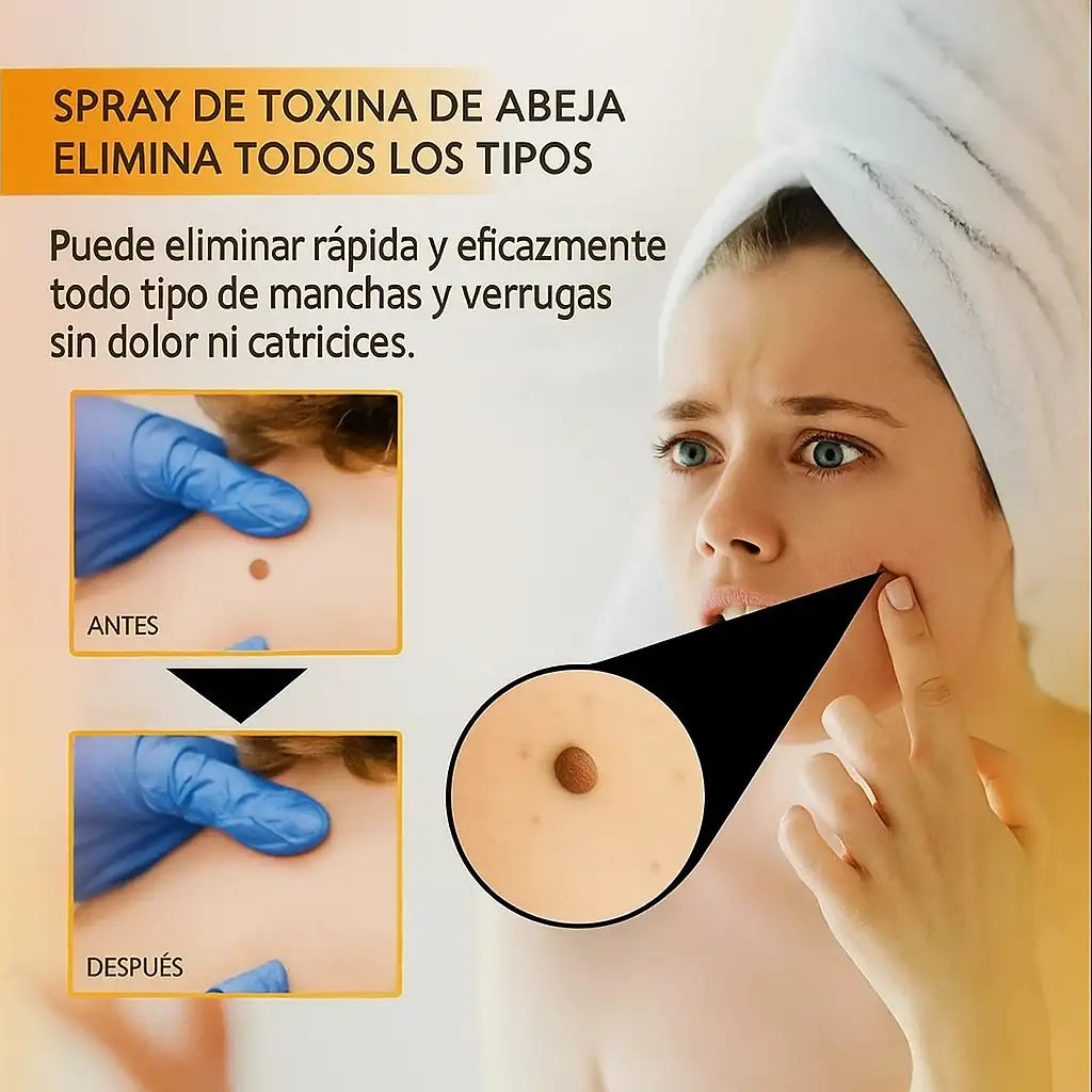 Spray "Tag Recede" con la nueva tecnología "Nano Fit Spot™ ➕ Envío Gratis