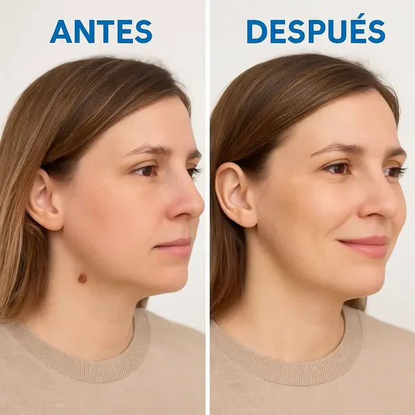 Removedor de Verrugas 🎁 Crema Reparadora Veneno de Abeja ➕ Envió Gratis