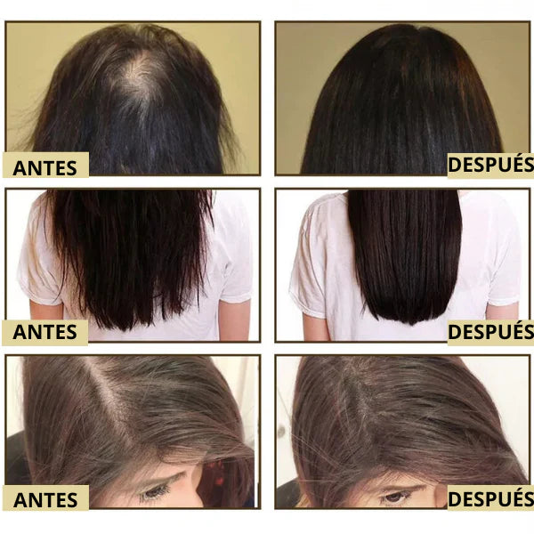 Aceite Natural Veganic 🎁 Compra 1 Lleva 2 - Para Doble Crecimiento del Cabello ➕ Envío Gratis