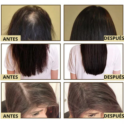Aceite Natural Veganic 🎁 Compra 1 Lleva 2 - Para Doble Crecimiento del Cabello ➕ Envío Gratis